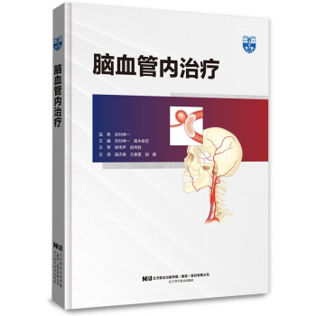 脑血管内治疗 下载