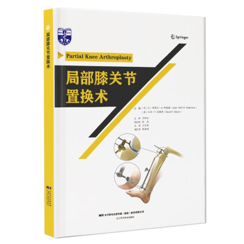 局部膝关节置换术 下载