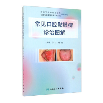 常见口腔黏膜病诊治图解 下载