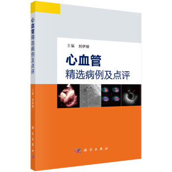 心血管精选病例及点评 下载