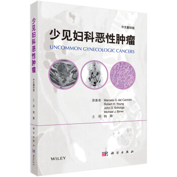 少见妇科恶性肿瘤（中文翻译版） 下载