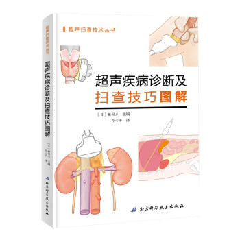 超声疾病诊断及扫查技巧图解 下载