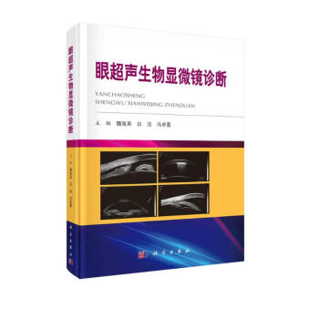 眼超声生物显微镜诊断 下载
