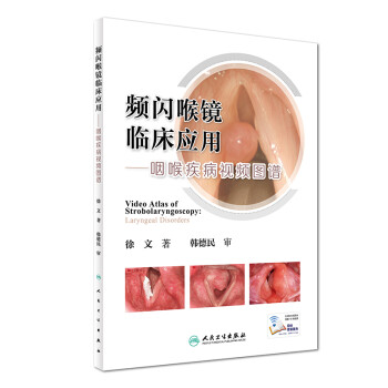 频闪喉镜临床应用·咽喉疾病视频图谱（配增值） 下载