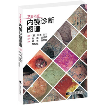 下消化道内镜诊断图谱 下载