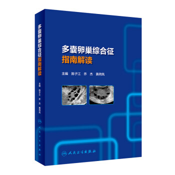 多囊卵巢综合征指南解读 下载