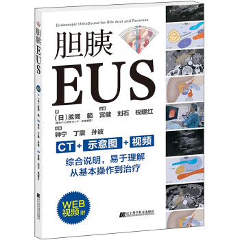胆胰EUS 下载
