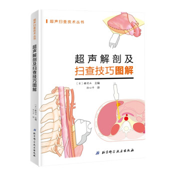 超声解剖及扫查技巧图解 下载