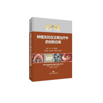 种植支抗在正畸治疗中的创新应用 下载