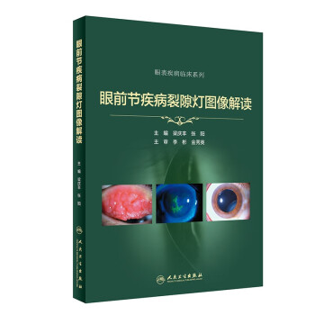 眼前节疾病裂隙灯图像解读 下载
