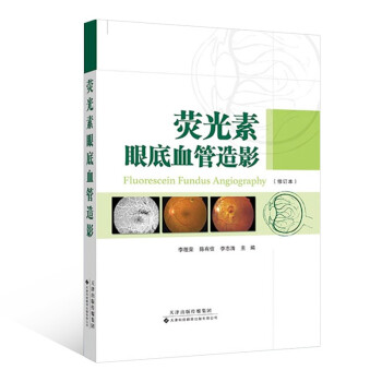 荧光素眼底血管造影 下载