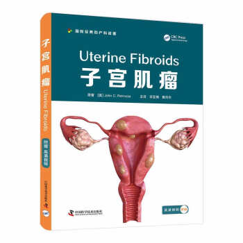 子宫肌瘤 下载