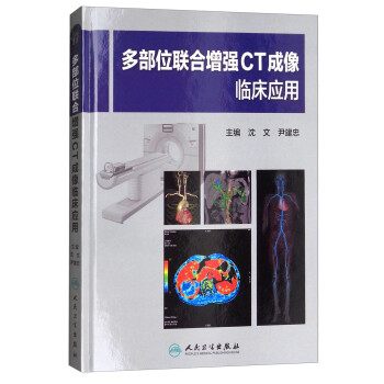 多部位联合增强CT成像临床应用 下载