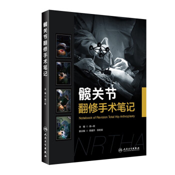 髋关节翻修手术笔记 下载