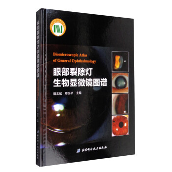 眼部裂隙灯生物显微镜图谱 [Biomicroscopic Atlas of General Ophthalmology] 下载