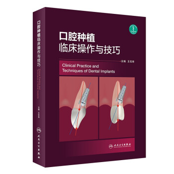 口腔种植临床操作与技巧 下载