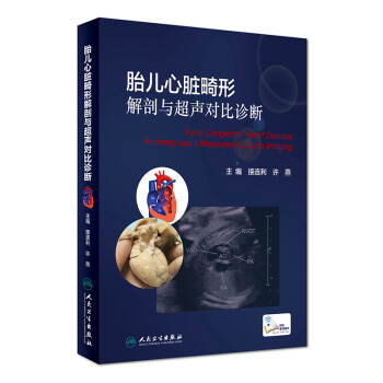 胎儿心脏畸形解剖与超声对比诊断(配增值) 下载