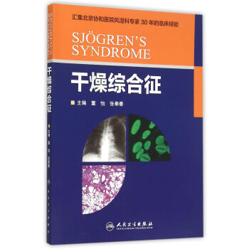 干燥综合征 下载