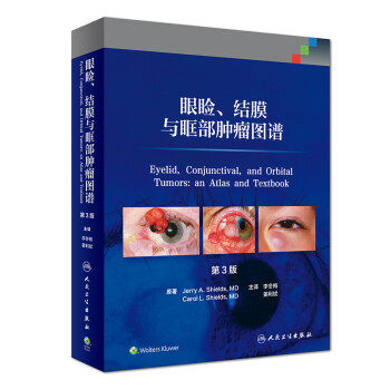 眼睑、结膜与眶部肿瘤图谱，第3版（翻译版） 下载