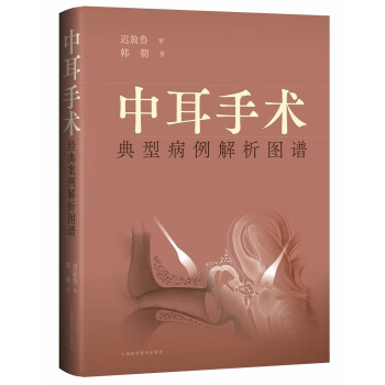 中耳手术典型病例解析图谱 下载