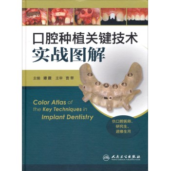 口腔种植关键技术实战图解（供口腔医师、研究生、进修生用） 下载