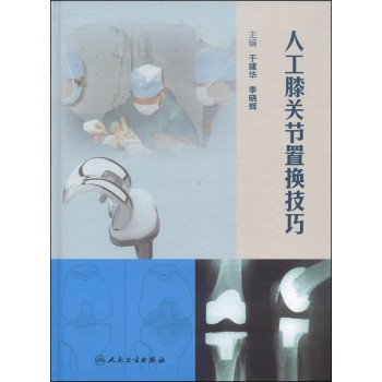 人工膝关节置换技巧 下载