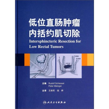 低位直肠癌括约肌间切除术（翻译版） 下载