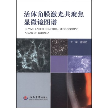 活体角膜激光共聚焦显微镜图谱 下载