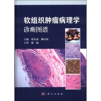 软组织肿瘤病理学诊断图谱 下载