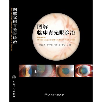 图解临床青光眼诊治 下载