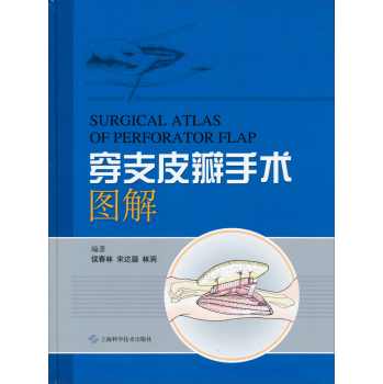 穿支皮瓣手术图解 下载