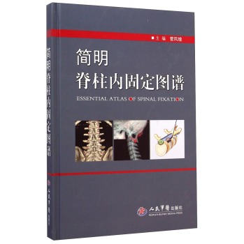 简明脊柱内固定图谱 下载