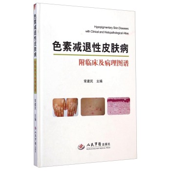 色素减退性皮肤病 下载