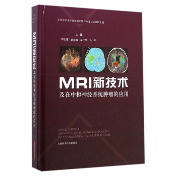 MRI新技术及在中枢神经系统肿瘤的应用 下载