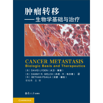 肿瘤转移：生物学基础及治疗 下载
