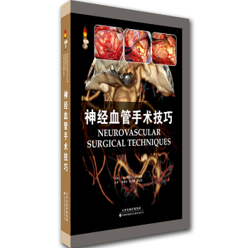 神经血管手术技巧 下载