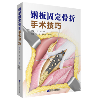 钢板固定骨折手术技巧 下载